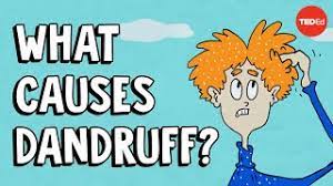 What Causes Dandruff?